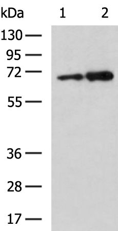 Rabbit Polyclonal Antibody to HEXA