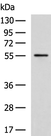 Rabbit Polyclonal Antibody to GDPD2