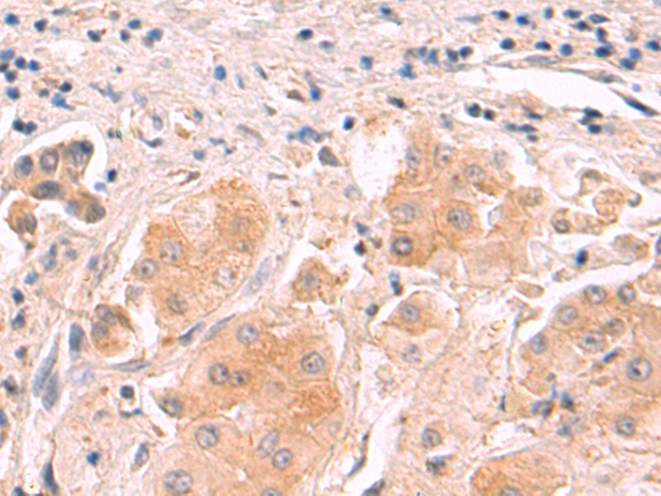 Rabbit Polyclonal Antibody to HABP2