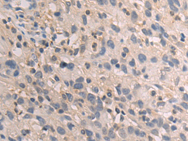 Rabbit Polyclonal Antibody to GBE1