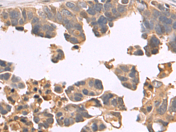 Rabbit Polyclonal Antibody to CMTR2