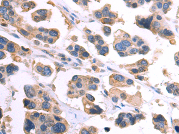 Rabbit Polyclonal Antibody to HGS