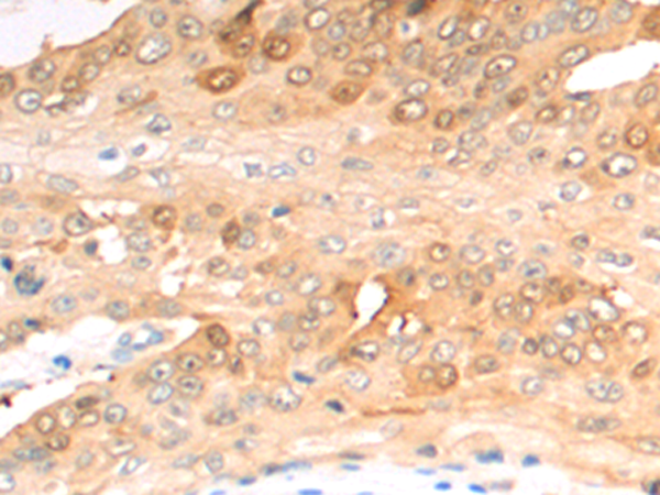 Rabbit Polyclonal Antibody to GSTM1