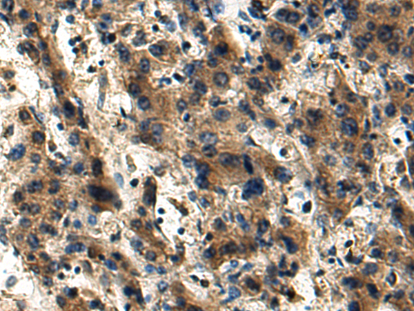 Rabbit Polyclonal Antibody to ENTPD4
