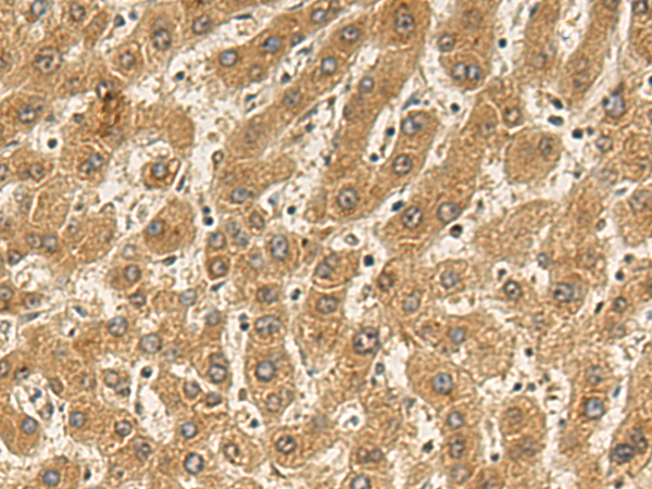 Rabbit Polyclonal Antibody to GLB1