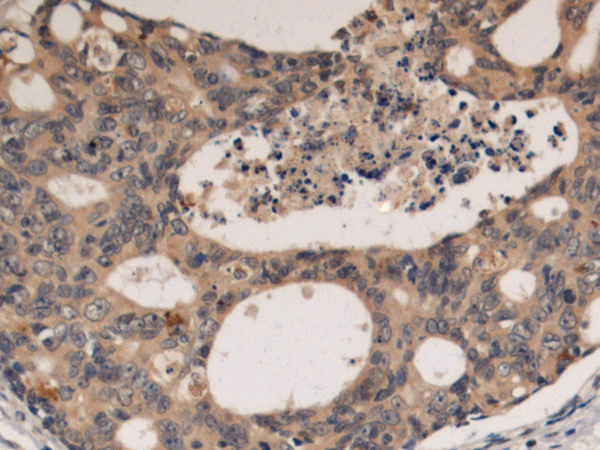 Rabbit Polyclonal Antibody to EML1
