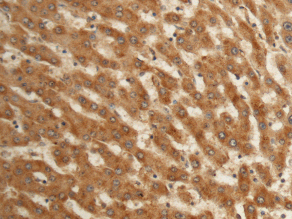 Rabbit Polyclonal Antibody to EFHC2