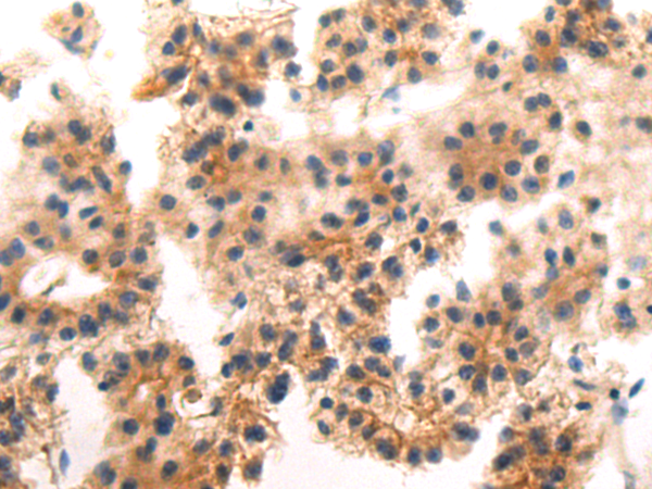 Rabbit Polyclonal Antibody to HOOK1