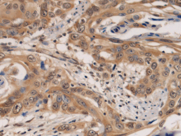 Rabbit Polyclonal Antibody to IQSEC1