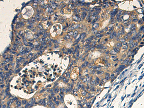 Rabbit Polyclonal Antibody to AP3B1