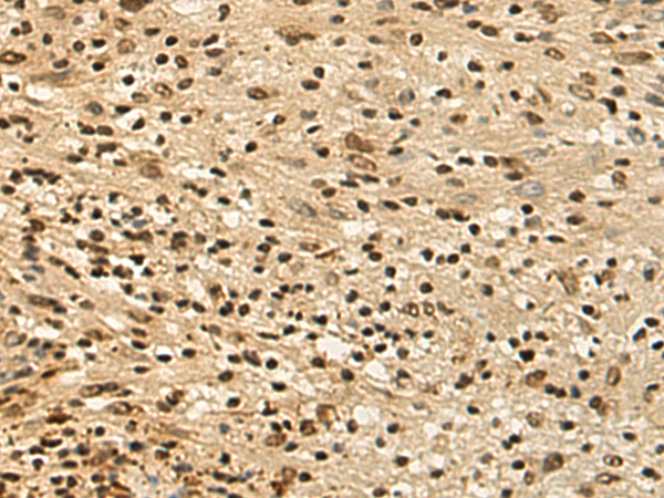 Rabbit Polyclonal Antibody to DHX38