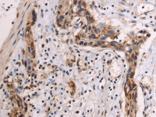 Rabbit Polyclonal Antibody to TIMM10B