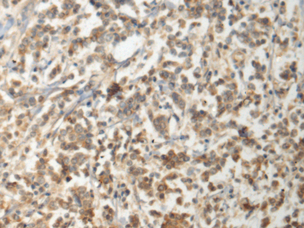 Rabbit Polyclonal Antibody to GEMIN6