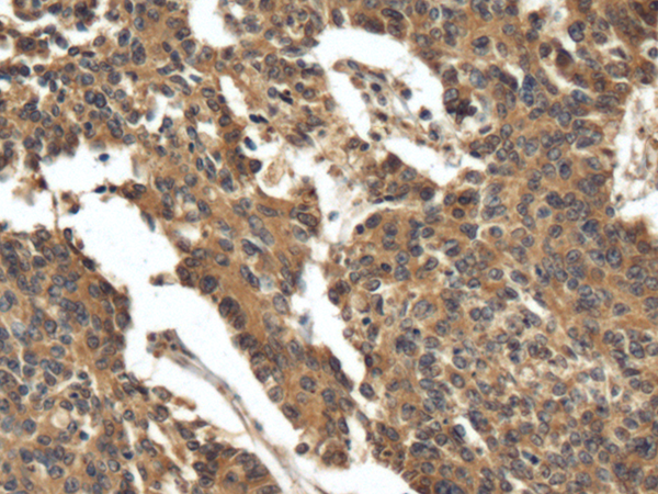 Rabbit Polyclonal Antibody to FIBIN