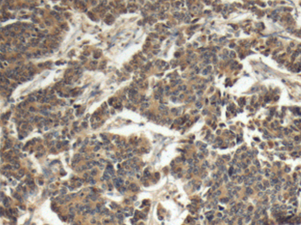 Rabbit Polyclonal Antibody to EIF3G