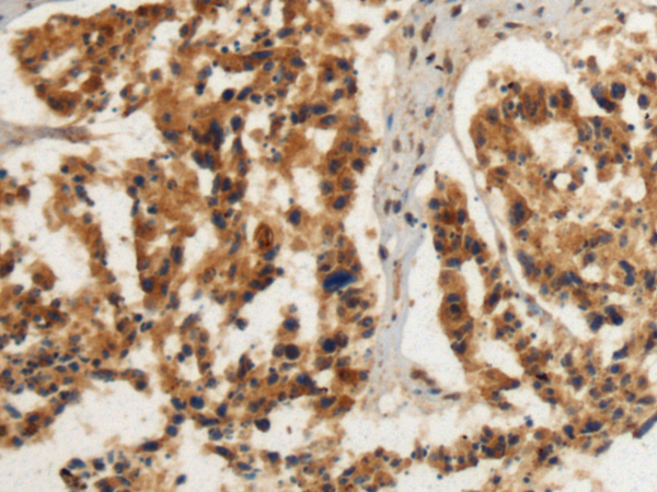 Rabbit Polyclonal Antibody to FDFT1