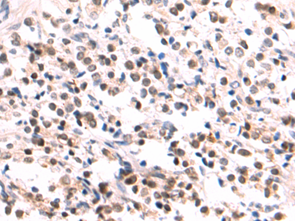 Rabbit Polyclonal Antibody to SUMO1