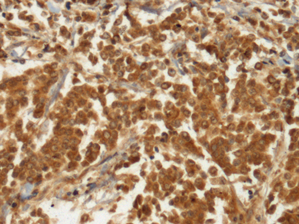 Rabbit Polyclonal Antibody to GUCY1B1