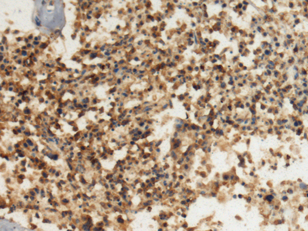 Rabbit Polyclonal Antibody to DHX8