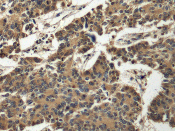 Rabbit Polyclonal Antibody to DNAI2