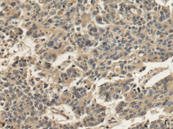 Rabbit Polyclonal Antibody to KATNA1