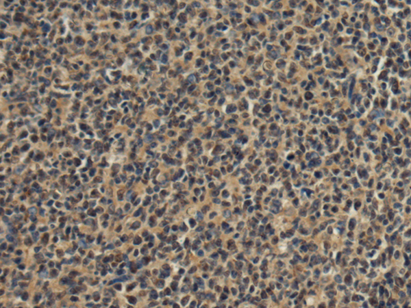 Rabbit Polyclonal Antibody to FRG1