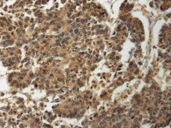 Rabbit Polyclonal Antibody to GTPBP2