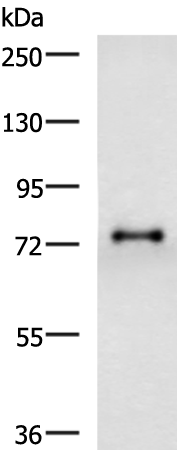 Rabbit Polyclonal Antibody to GALNT3