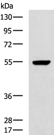 Rabbit Polyclonal Antibody to GBA3