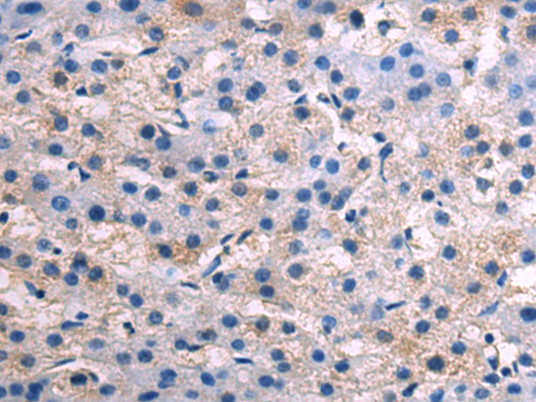 Rabbit Polyclonal Antibody to SPINK1