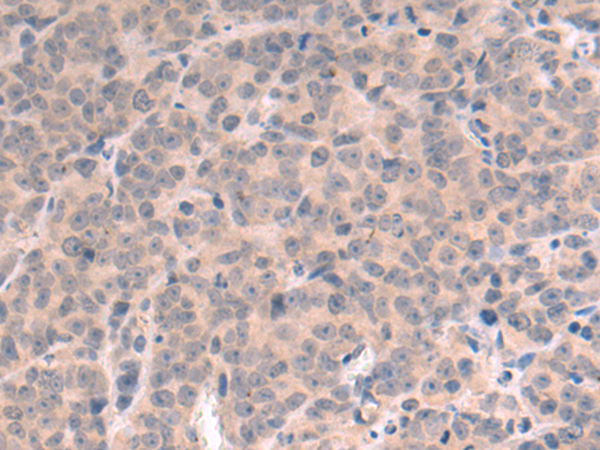 Rabbit Polyclonal Antibody to FBXO42
