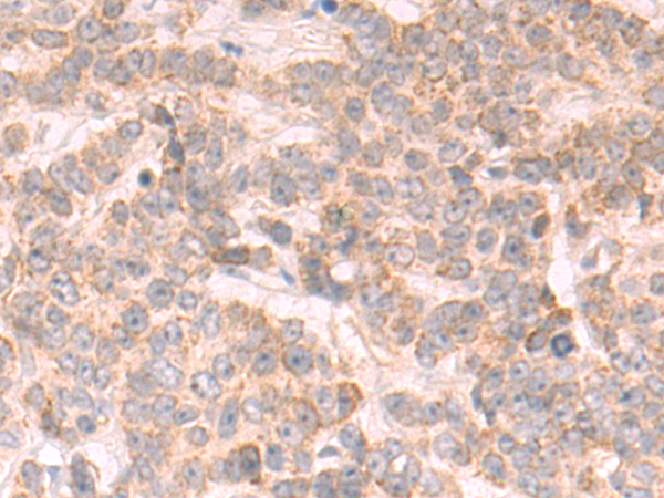 Rabbit Polyclonal Antibody to DHX57