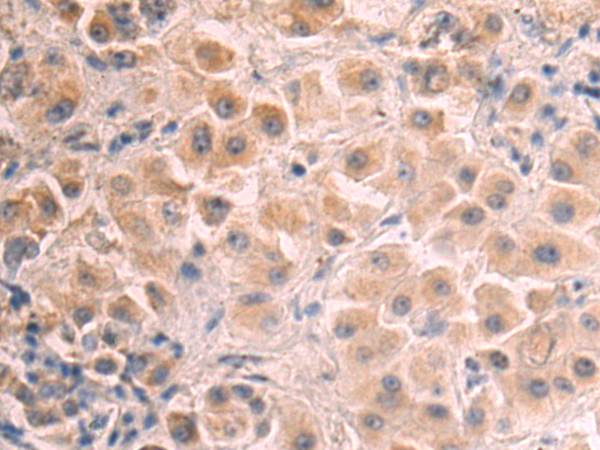Rabbit Polyclonal Antibody to KCTD18