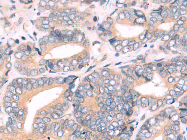 Rabbit Polyclonal Antibody to RBP3