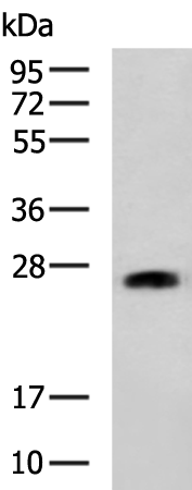 Rabbit Polyclonal Antibody to GSTM5