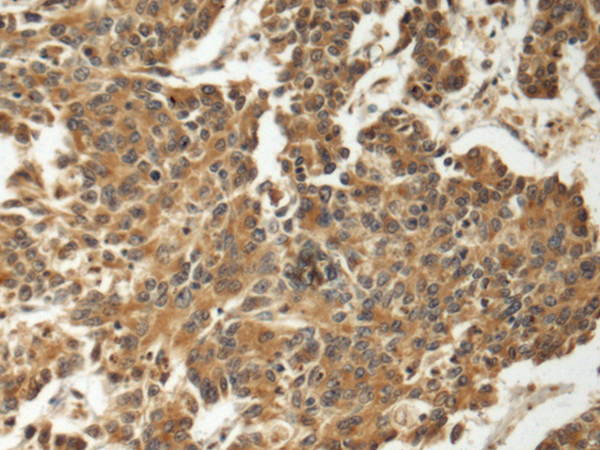 Rabbit Polyclonal Antibody to FCSK