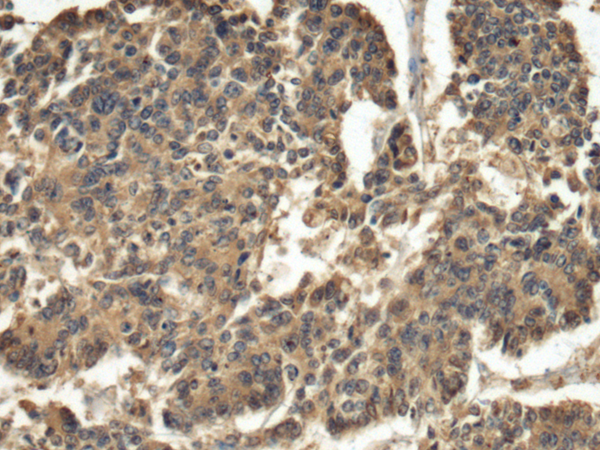 Rabbit Polyclonal Antibody to HLA-DOA
