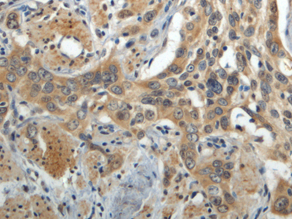 Rabbit Polyclonal Antibody to HEPH