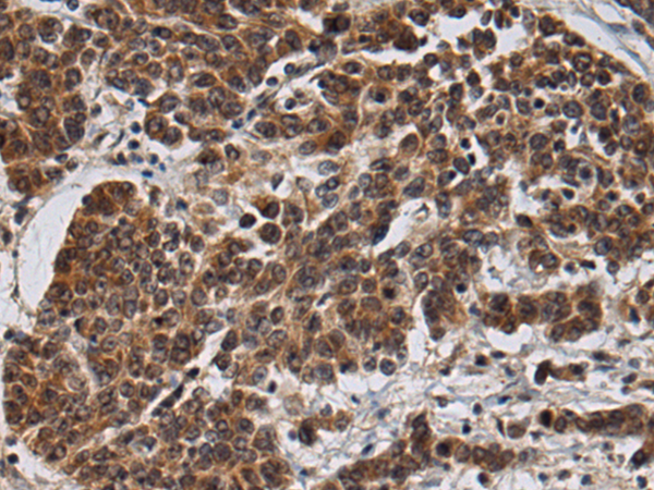 Rabbit Polyclonal Antibody to DIP2A