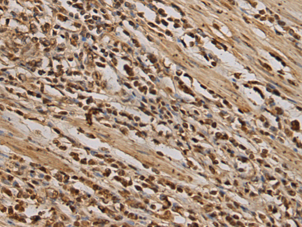 Rabbit Polyclonal Antibody to LBH