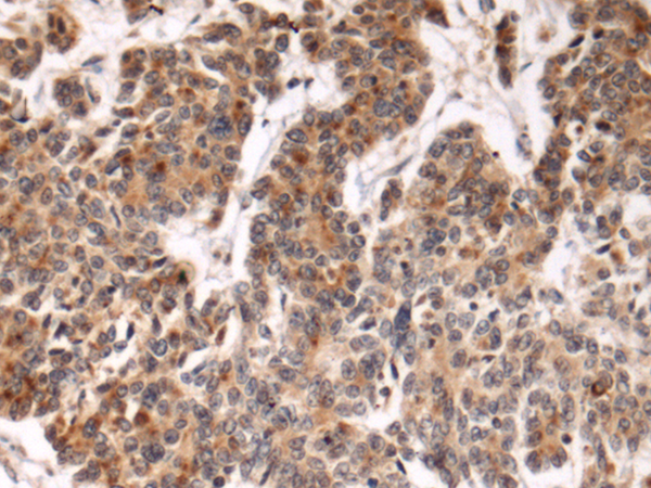 Rabbit Polyclonal Antibody to FBXL21P
