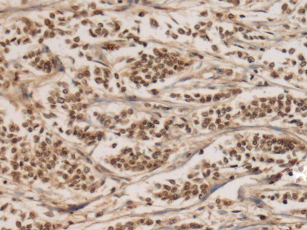 Rabbit Polyclonal Antibody to FBXL17