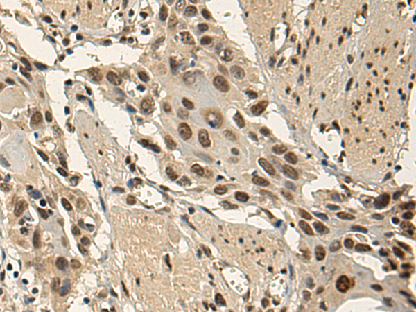 Rabbit Polyclonal Antibody to EBF3