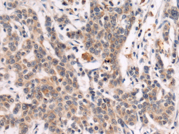 Rabbit Polyclonal Antibody to GALNT3
