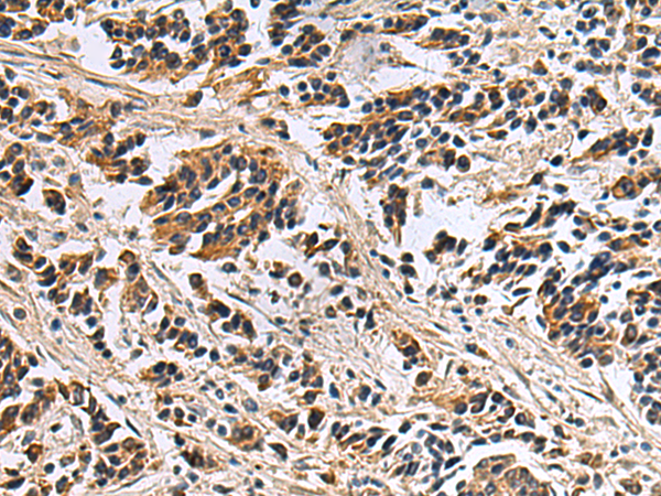 Rabbit Polyclonal Antibody to DIAPH2
