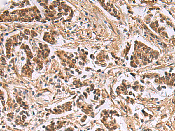 Rabbit Polyclonal Antibody to DNA2