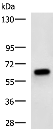 Rabbit Polyclonal Antibody to KBTBD8