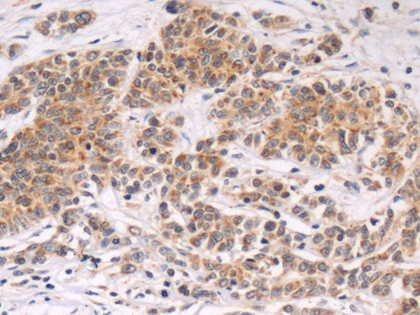 Rabbit Polyclonal Antibody to ERMAP