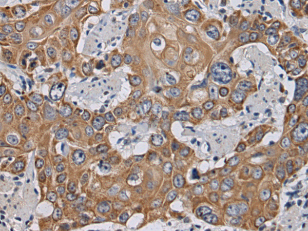 Rabbit Polyclonal Antibody to TSSK4