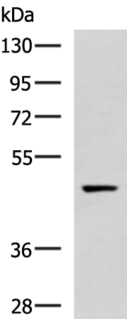 Rabbit Polyclonal Antibody to GLT8D1